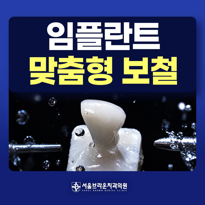 잇몸 형태와 교합을 고려한 맞춤형 임플란트 보철