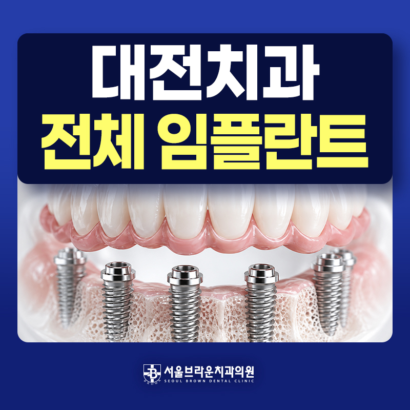 대전 전체 임플란트 치료 방법 안내