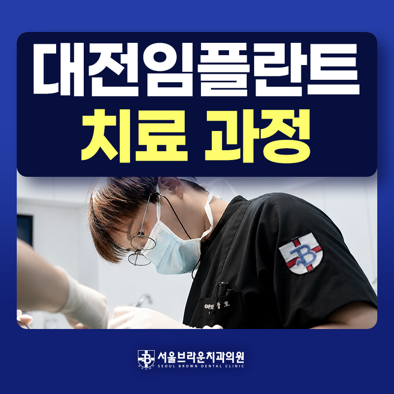 대전 임플란트 진단부터 최종 보철까지 치료과정 안내