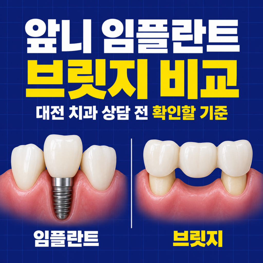 앞니 임플란트와 브릿지의 차이, 대전 치과 상담 전 확인할 기준